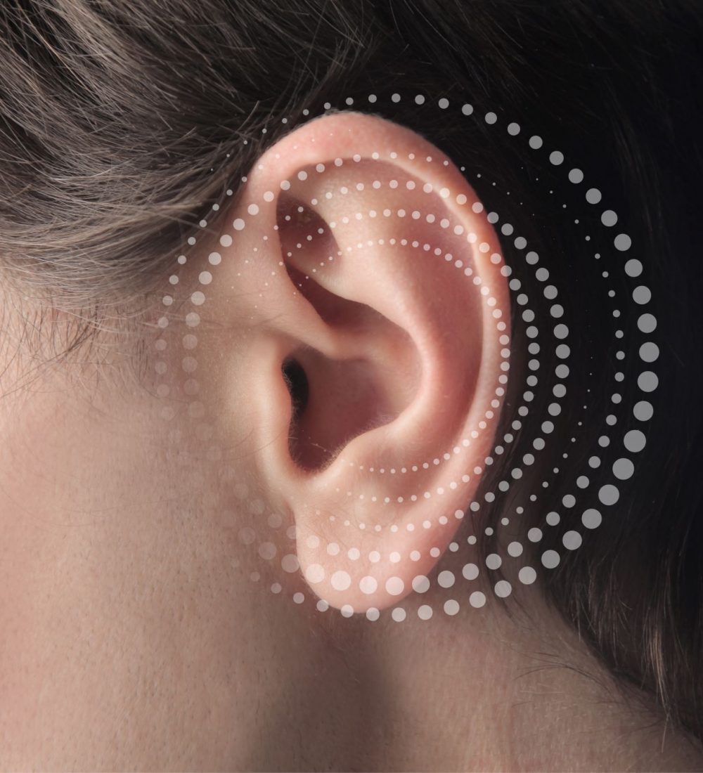 Lobuloplastia Lobuloplastia