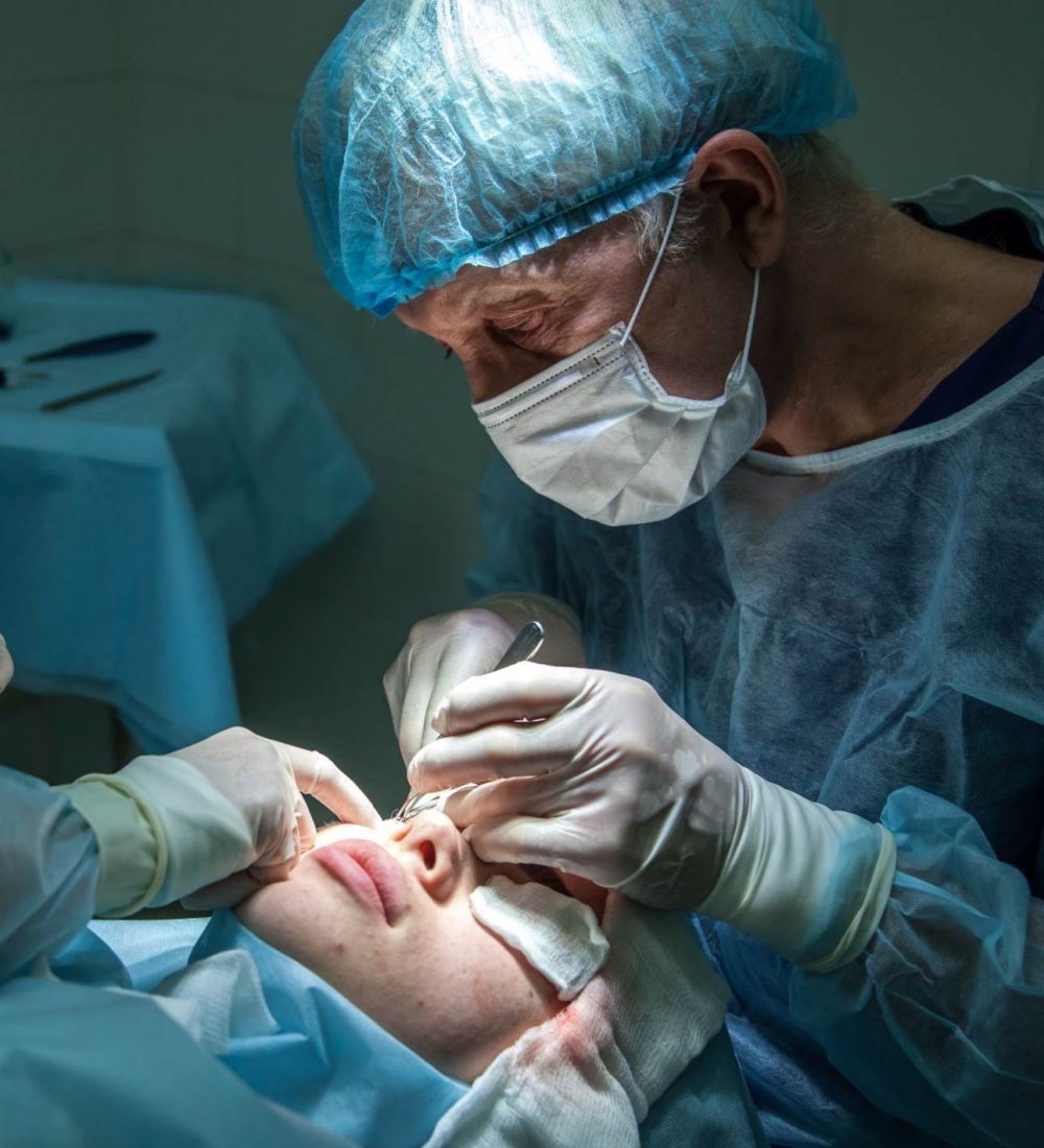 rinoplastia2 rinoplastia2