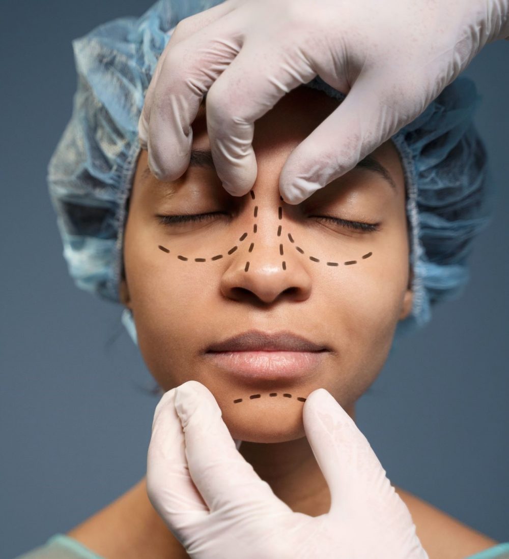 rinosspetoplastia rinosspetoplastia